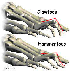 toe1